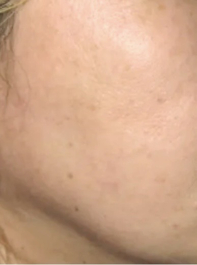 アフター 40代